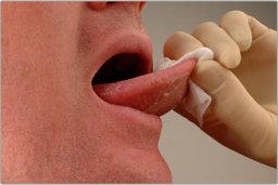Mouth Cancer Soft Tissue exam